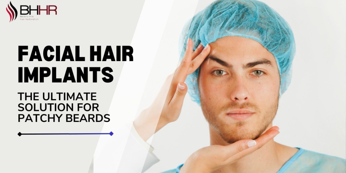 Breaking Down Hair Transplant Costs in California