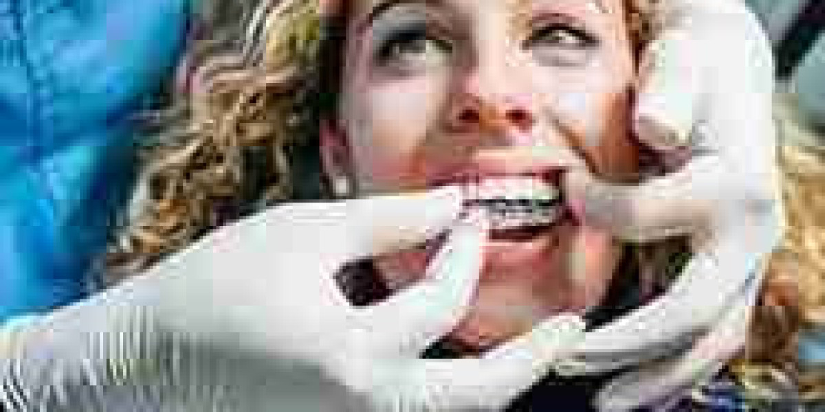 Why Choose Invisalign to Straighten Your Smile?