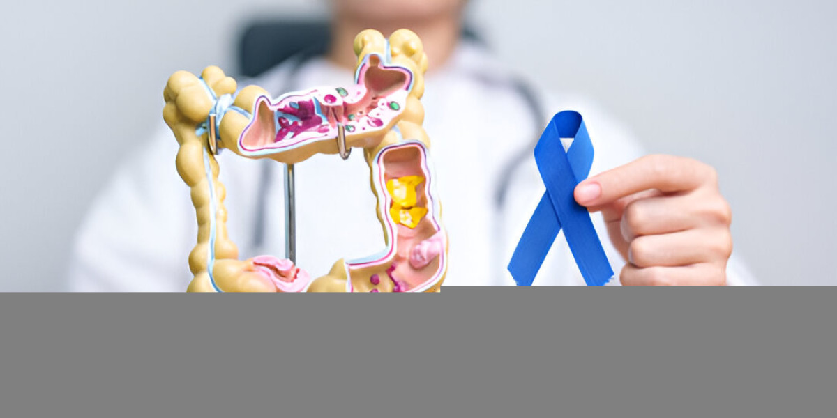 Effective Colon Cancer Treatment Options in Singapore