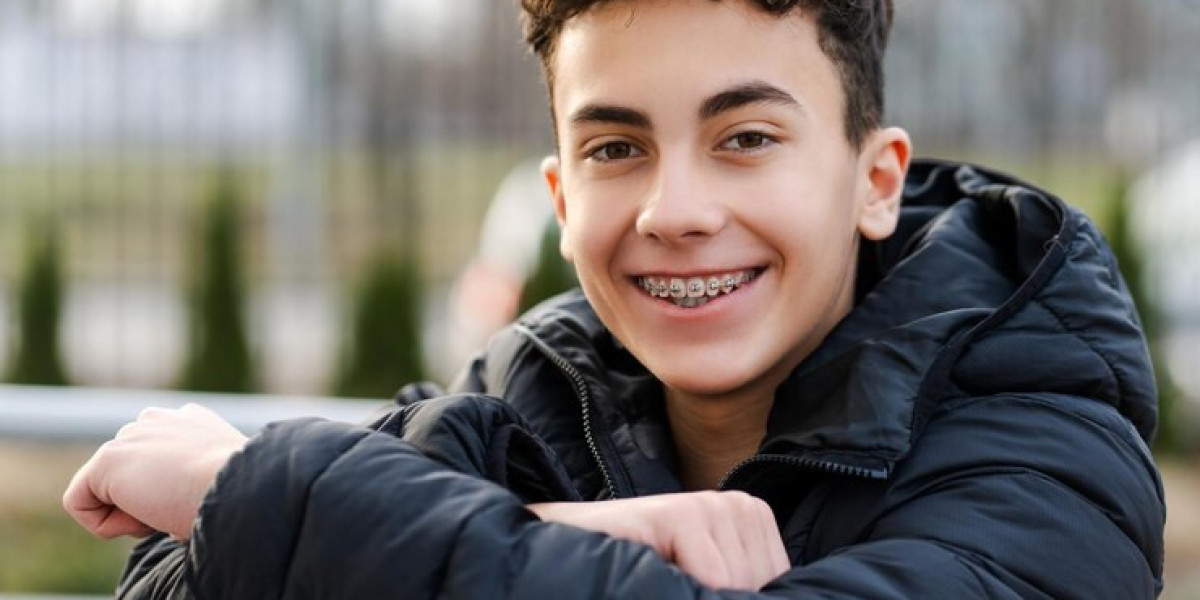 Aesthetic Alternatives to Traditional Braces: Spotlight on Champagne Braces