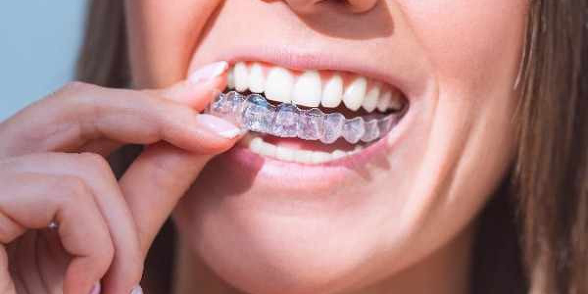 Local Clinics Helping You Achieve Healthy Smiles in High Wycombe