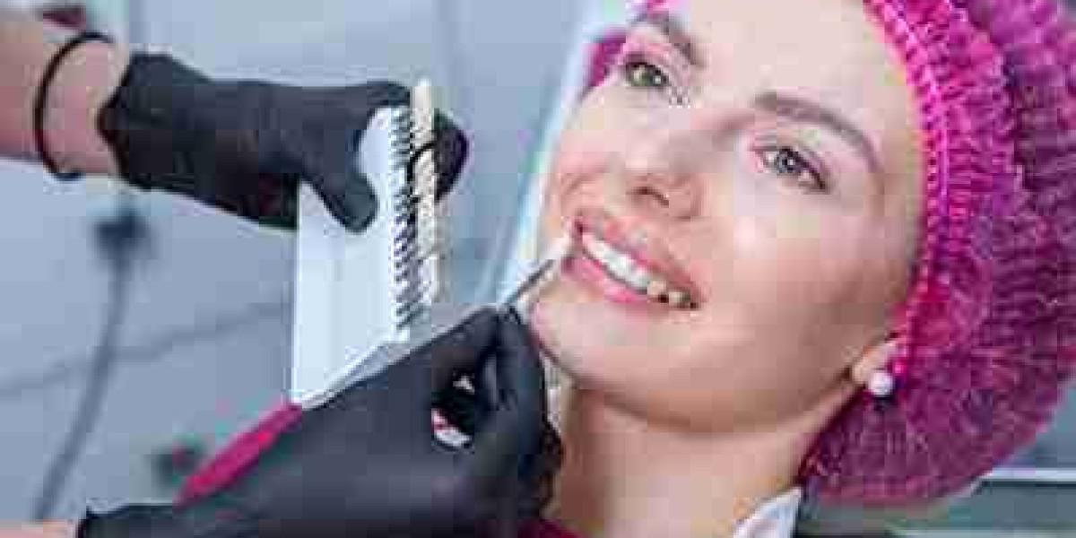 The Smile Upgrade You Didn’t Know You Needed in Sheffield